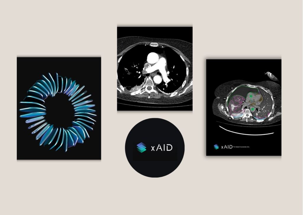 Discover Trusted Teleradiology Partners for AI Imaging copy of white and teal image collage retirement card 1789052249948 e1c38167